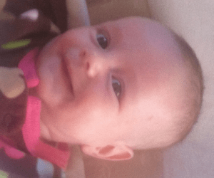 The scratch on Naomi's left temple, after her near fall